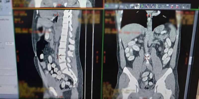Lotnisko Chopina: W żołądku przemycał ponad kilogram kokainy