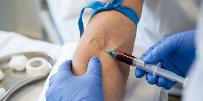 Badania krwi jako podstawa profilaktyki – co sprawdzać raz w roku?