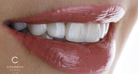 Cićkiewicz Clinic – standard, który zmienia podejście do leczenia zębów w Warszawie